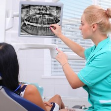 Dentist Bonding San Diego