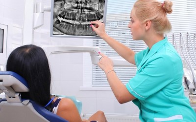 Dentist Bonding San Diego